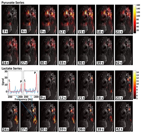 Pyruvate and lactate dynamics from 2D EPSI in canine patient with tumor. The figure also shows the spectrum with GLM fitting at the tumor site in the EPSI frame acquired 27 s from time of injection.